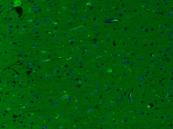 HRG beta 1 Rabbit Polyclonal A