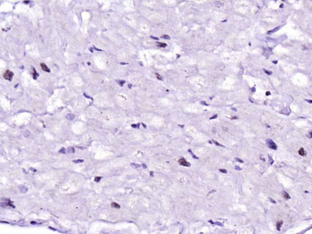 Nkx2.5 Rabbit Polyclonal Antib