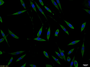 Phospho-Doublecortin (Ser47) R