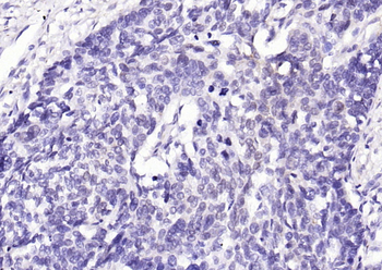 Phospho-YAP1 (Tyr407) Rabbit P