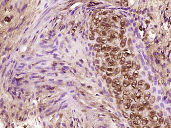CCL26 Rabbit Polyclonal Antibo