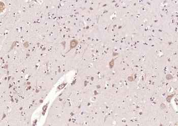 BLNK Rabbit Polyclonal Antibod