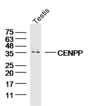 CENPP Rabbit Polyclonal Antibo