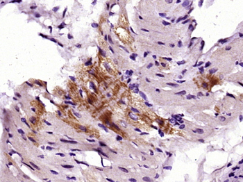 Phospho-FRS2 (Tyr436) Rabbit P
