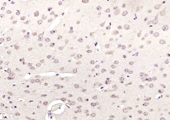 RFC1 Rabbit Polyclonal Antibod