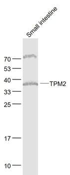 TPM2 Rabbit Polyclonal Antibod