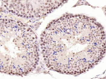 Phospho-CDKN1A/p21 (Thr57) Rab