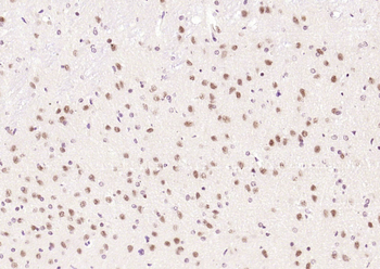 BNC1 Rabbit Polyclonal Antibod