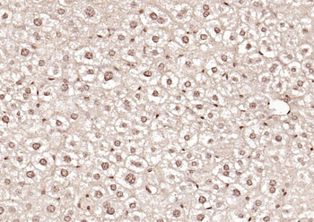 PPM1D Rabbit Polyclonal Antibo