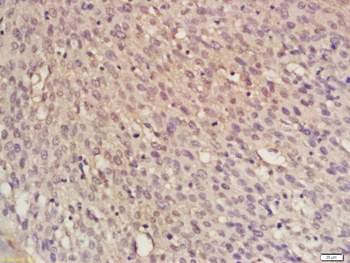 RFC1 Rabbit Polyclonal Antibod