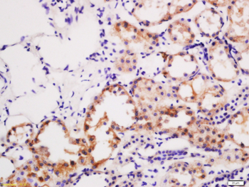 SLC22A12 Rabbit Polyclonal Ant