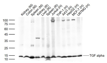 TGF alpha Rabbit Polyclonal An