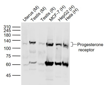 Phospho-Progesterone Receptor