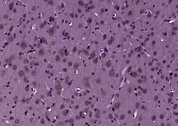 MLC1 Rabbit Polyclonal Antibod