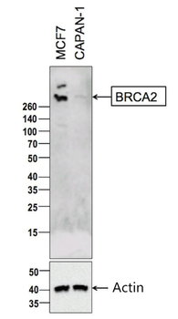 BRCA2 Rabbit Polyclonal Antibo