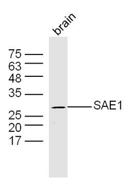 SAE1 Rabbit Polyclonal Antibod