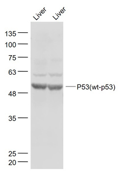 P53 (wt-p53) Rabbit Polyclonal