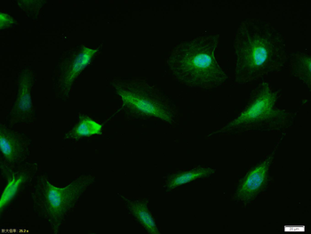 P53 (wt-p53) Rabbit Polyclonal