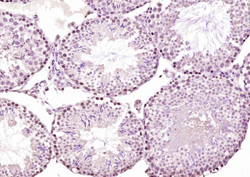 Bub1 Rabbit Polyclonal Antibod