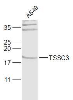 TSSC3 Rabbit Polyclonal Antibo