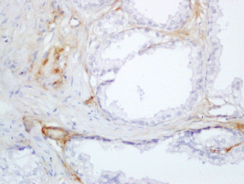 SRD5A2 Rabbit Polyclonal Antib