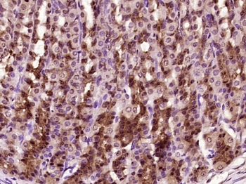 Phospho-YAP1 (Tyr407) Rabbit P