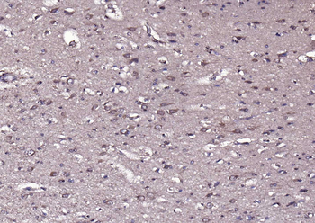 Phospho-PYK2 (Tyr402) Rabbit P