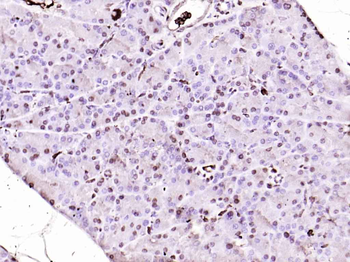 MT2A Rabbit Polyclonal Antibod