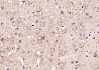 PIP5KL1 Rabbit Polyclonal Anti