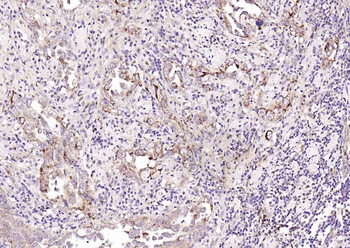 CDKN3 Rabbit Polyclonal Antibo