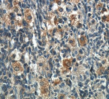 POTEA Antibody抗体，orb630101，bio