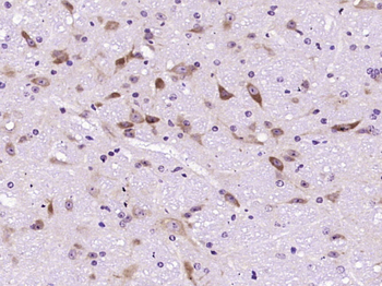 Uricase Rabbit Polyclonal Anti