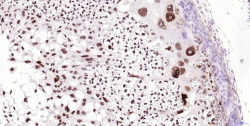 Phospho-H2AX (Ser139) Recombin