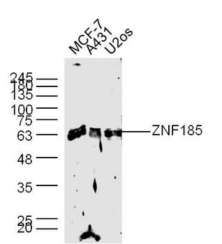 ZNF185 Rabbit Polyclonal Antib