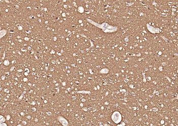 Tubulin beta-III Recombinant R