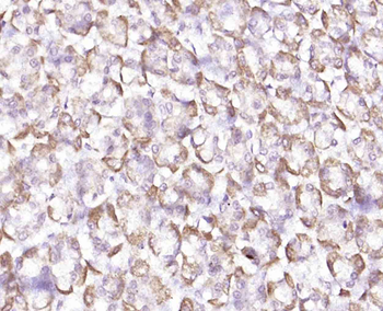 KATNA1 Rabbit Polyclonal Antib