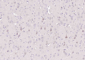 VAT1L Rabbit Polyclonal Antibo