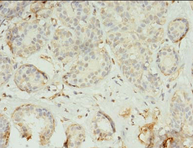 TMEM45A Antibody抗体,orb357227,b