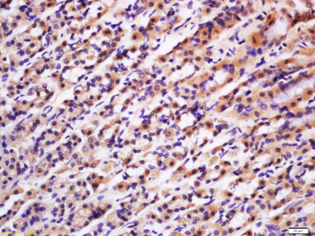 Phospho-PRKCB (Thr642) Rabbit 