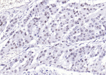 Phospho-YAP1 (Tyr407) Rabbit P