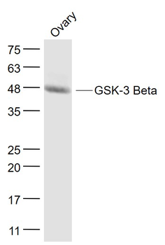 GSK-3 Beta Mouse Monoclonal An
