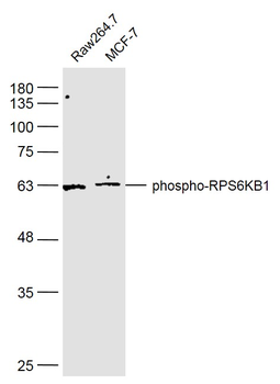 Phospho-RPS6KB1 (Ser427) Rabbi