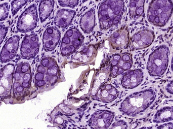 Galectin 3 Mouse Monoclonal An