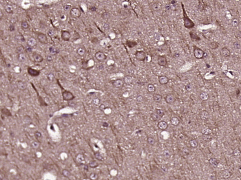 GLUR4 Rabbit Polyclonal Antibo