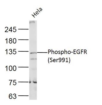 Phospho-EGFR (Ser991) Rabbit P