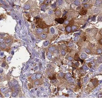 ACTR2 Antibody抗体,orb624875,bio