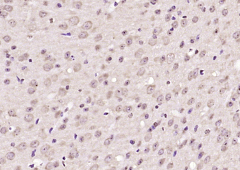 Phospho-PYK2 (Tyr402) Rabbit P