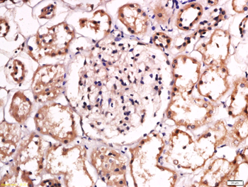 SPTBN2 Rabbit Polyclonal Antib