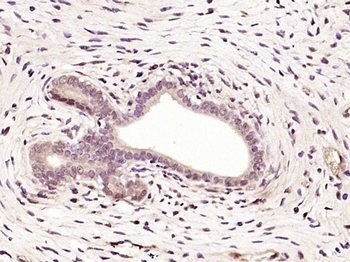 TSEN15/C1orf19 Rabbit Polyclon