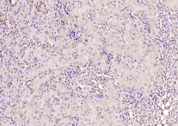 PPM1D Rabbit Polyclonal Antibo